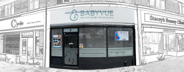 Photo - Babyvue