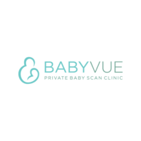 Babyvue